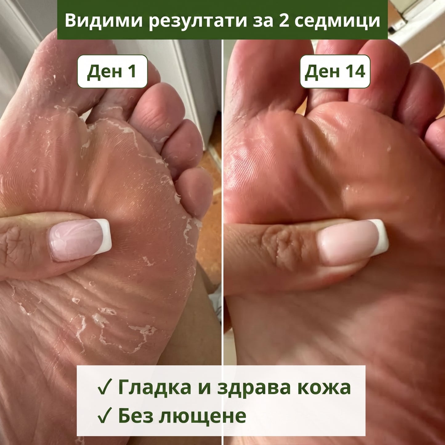 FUNGI CLEAR — Антигъбичен сапун с чаено дърво за крака