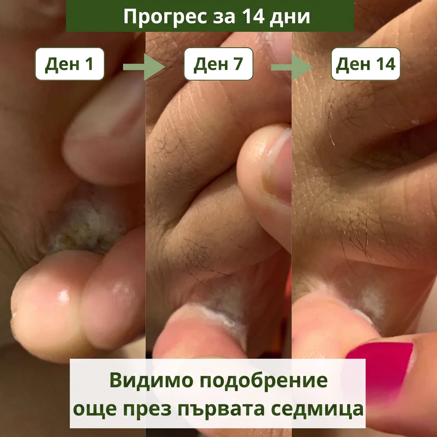 FUNGI CLEAR — Антигъбичен сапун с чаено дърво за крака